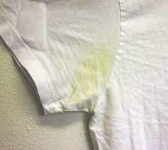 Yellow stains on white T-shirt